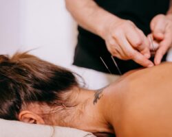 Benefits of Acupuncture for Female Athletes